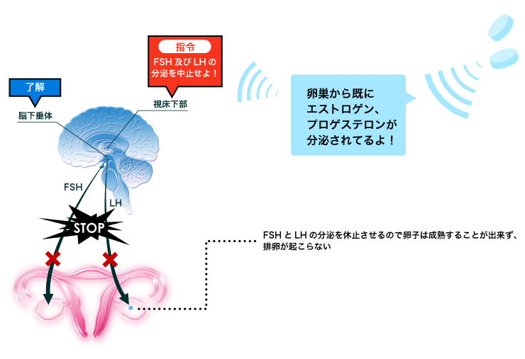 ピル 中止 後 胸 の 張り